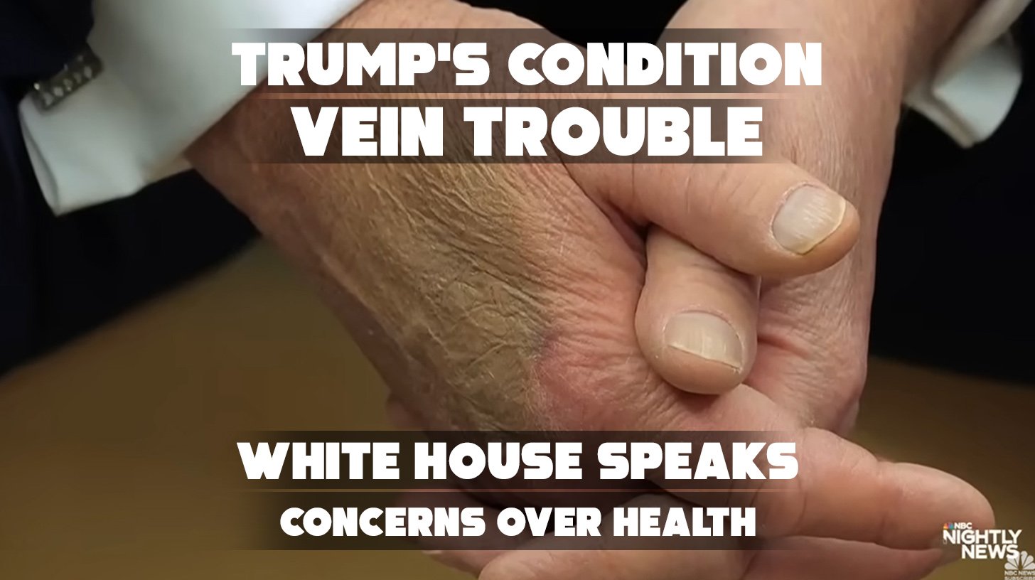Donald Trump walking on White House lawn following health announcement about chronic venous insufficiency.