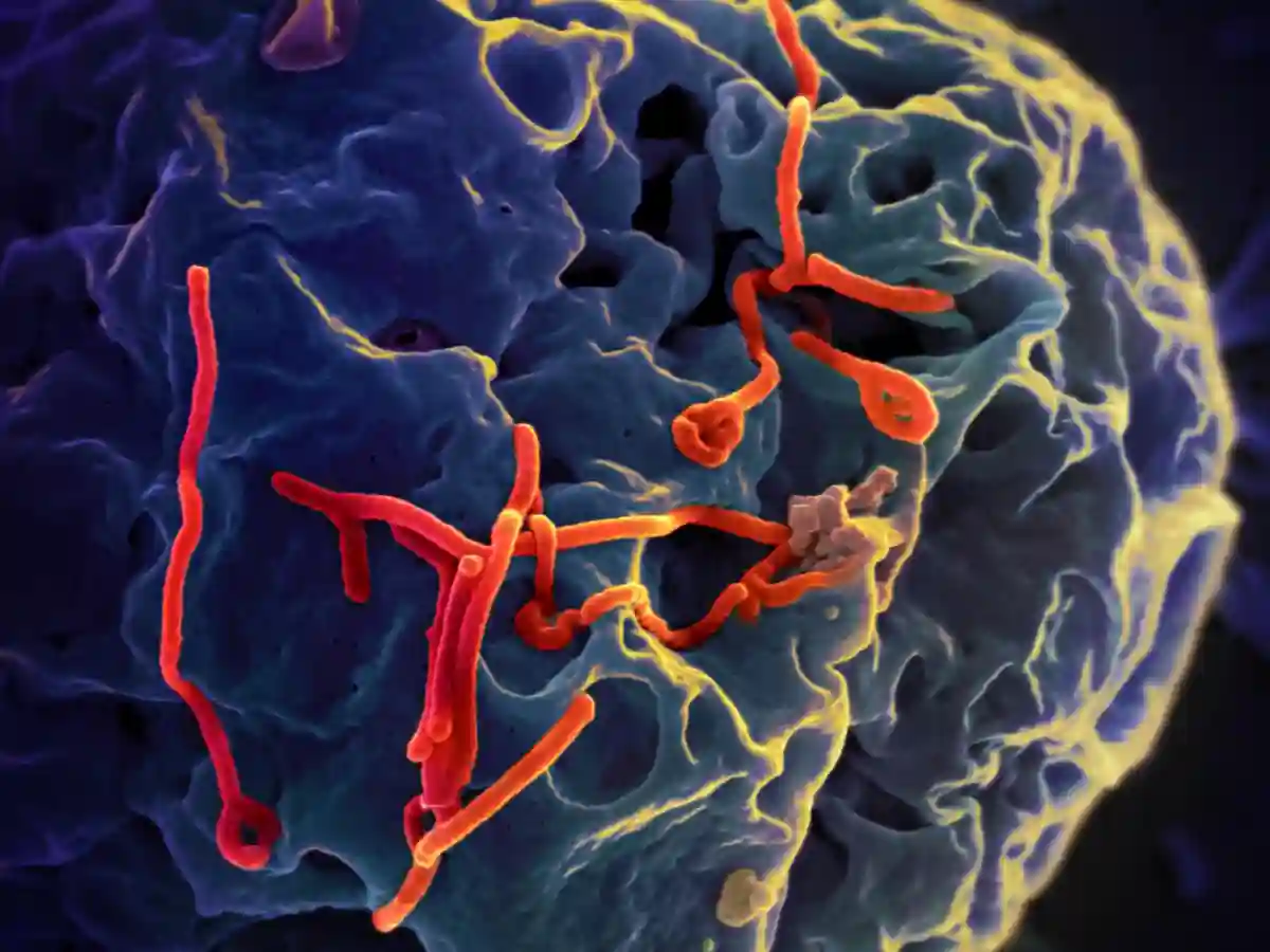 Scanning electron micrograph of Ebola virus budding from the surface of a Vero cell Scanning electron micrograph of Ebola virus budding from the surface of a Vero cell