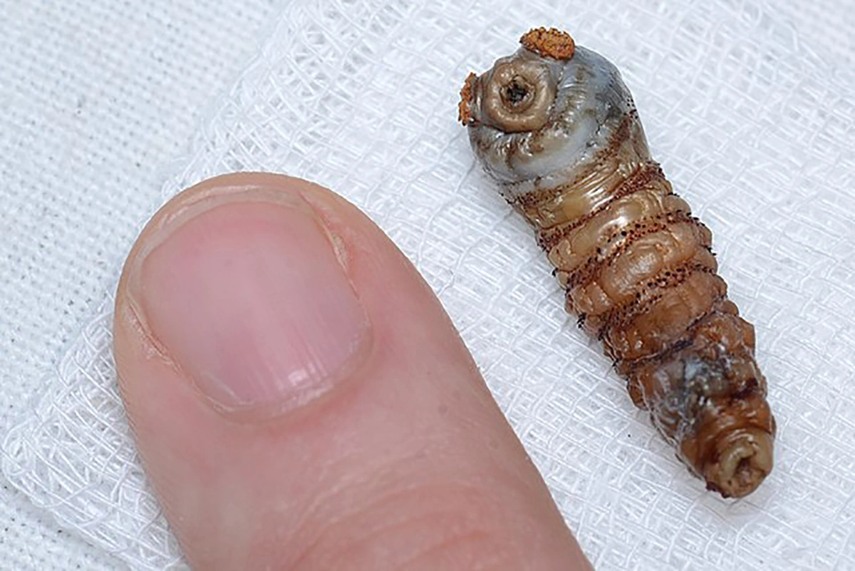 Human Botfly Dermatobia hominis larva 17.07.2025