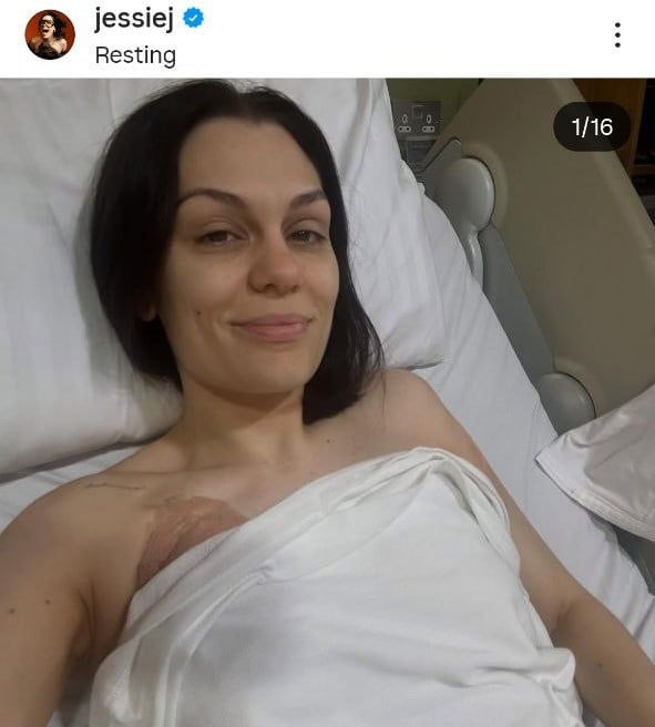 Jessie J’s Recovery Setback: Singer Back in Hospital Weeks After Cancer Battle
Jessie J’s Recovery Setback: Singer Back in Hospital Weeks After Cancer Battle