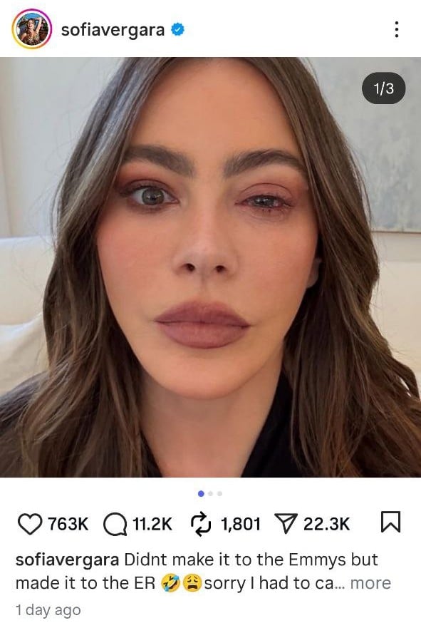 People Sofía Vergara Spends Emmys 2025 in the Emergency Room Due to to 'Craziest Eye Allergy People Sofía Vergara Spends Emmys 2025 in the Emergency Room Due to to 'Craziest Eye Allergy